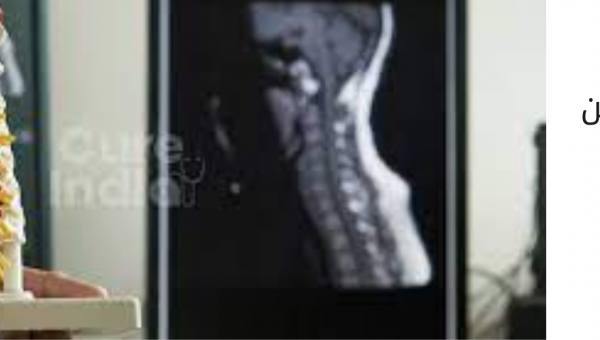 عملية استئصال ورم في العمود الفقري في الهند